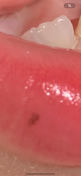 Bild zu Nachtrag - Haut von Babys und Kindern ✔️ Expertenforum