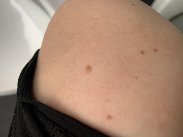 Bild zu Nochmal Nachtrag - Haut von Babys und Kindern ✔️ Expertenforum