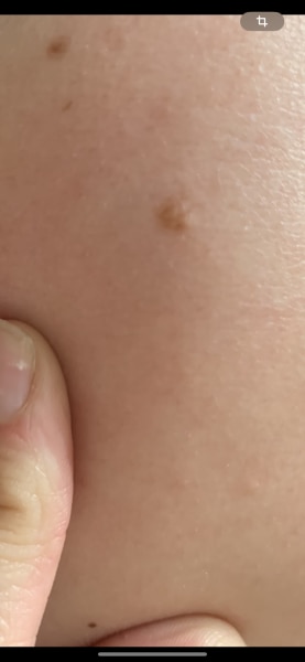 Bild zu Nochmal Nachtrag - Haut von Babys und Kindern ✔️ Expertenforum