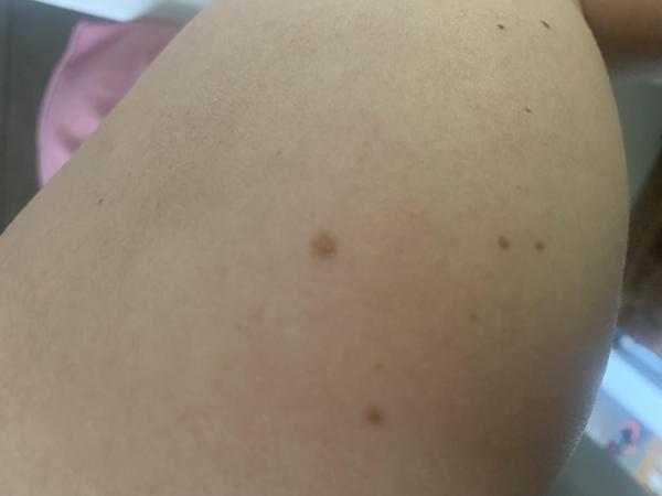 Bild zu Nachtrag - Haut von Babys und Kindern ✔️ Expertenforum
