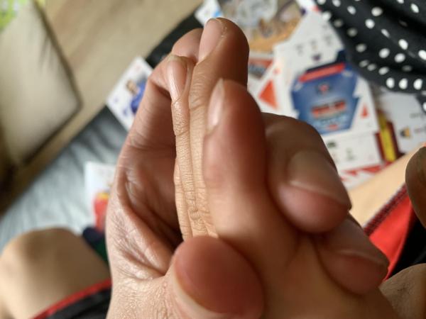 Bild zu Zusatz Fotos - Haut von Babys und Kindern ✔️ Expertenforum