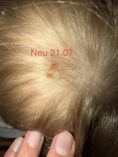 Bild zu 