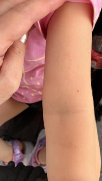 Bild zu Hautausschlag - Haut von Babys und Kindern ✔️ Expertenforum