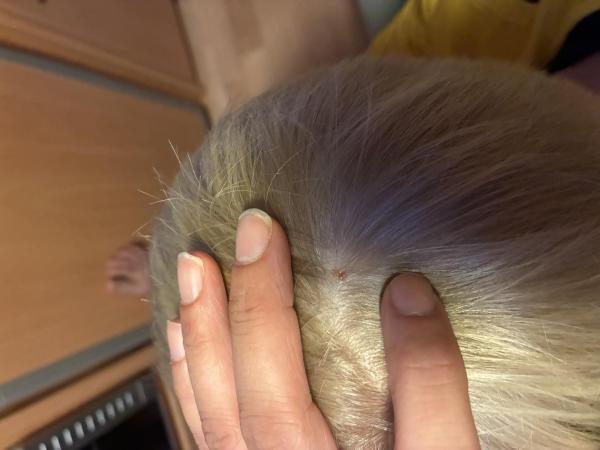 Bild zu Letzte Frage - Haut von Babys und Kindern ✔️ Expertenforum