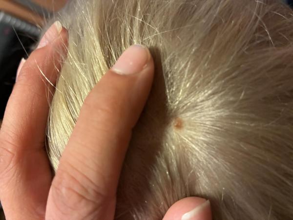 Bild zu Nochmal Fotos - Haut von Babys und Kindern ✔️ Expertenforum