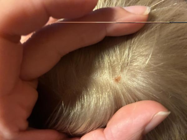 Bild zu Nochmal Fotos - Haut von Babys und Kindern ✔️ Expertenforum