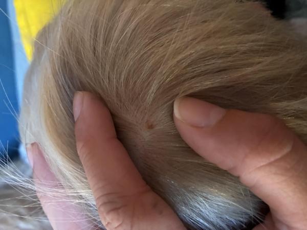 Bild zu Muttermal - Haut von Babys und Kindern ✔️ Expertenforum