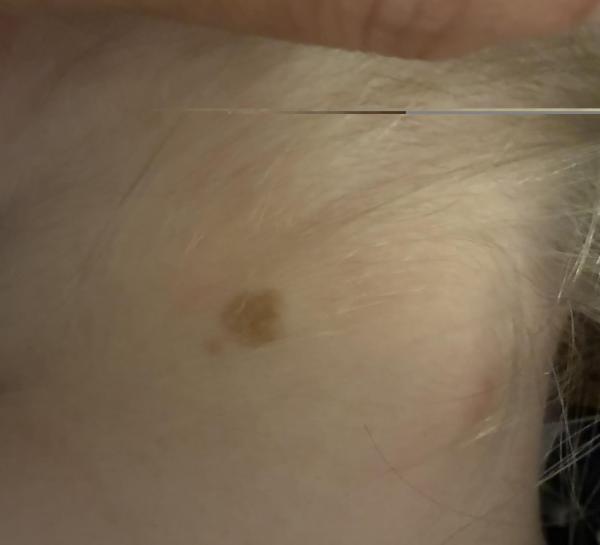 Bild zu Und nochmal die beiden letzten Bilder zum Anliegen ! - Haut von Babys und Kindern ✔️ Expertenforum