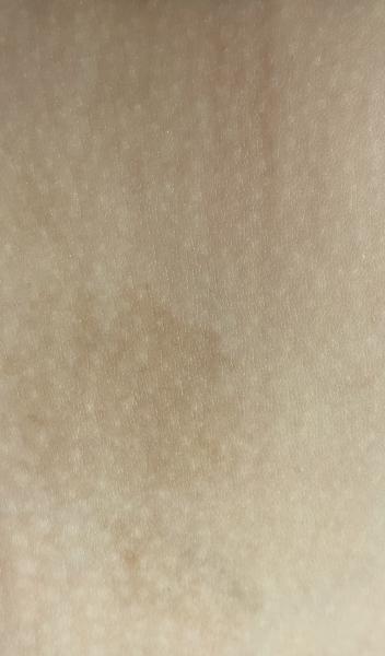 Bild zu Bessere Fotos zum Anliegen - Haut von Babys und Kindern ✔️ Expertenforum