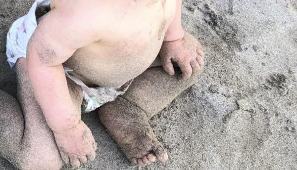 Bild zu Hautirra - Haut von Babys und Kindern ✔️ Expertenforum