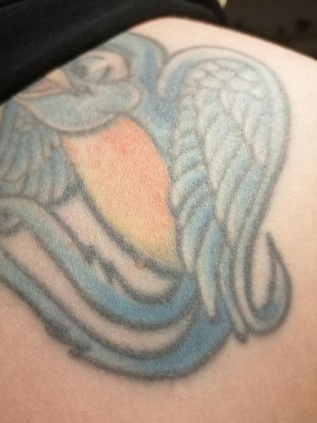Bild zu Nachtrag helles Muttermal - Haut von Babys und Kindern ✔️ Expertenforum