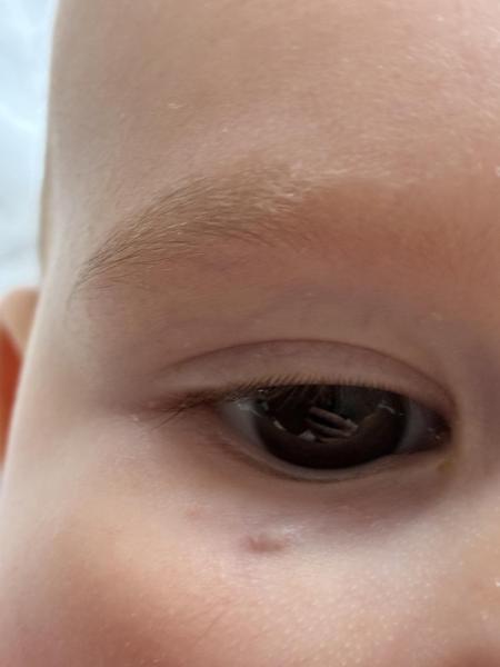 Bild zu was ist das für eine Stelle? - Haut von Babys und Kindern ✔️ Expertenforum