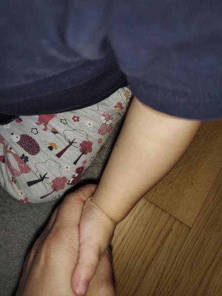 Bild zu Hautausschlag - Haut von Babys und Kindern ✔️ Expertenforum