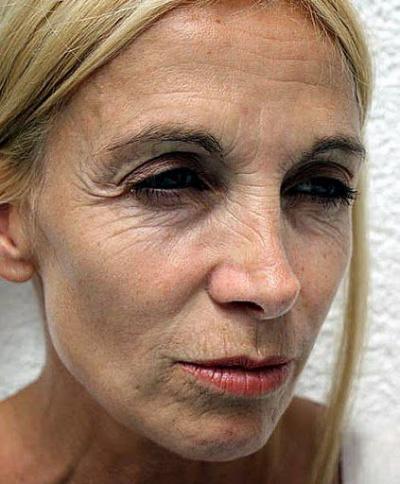 Bild zu Hyalyronsäre von Innen Anti aging - Wellness, Fitness und Beauty