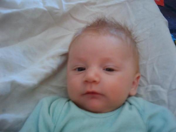Bild zu