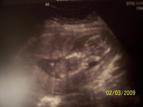 Bild zu @silke und alle die es interessiert :) - Diätclub - Forum und Erfahrungsaustausch