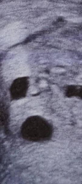 Bild zu Wer kann mir was zu diesem ultraschall Bild sagen? - Kleine Engel