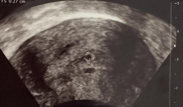 Bild zu Früher Abgang oder nicht? - Kleine Engel