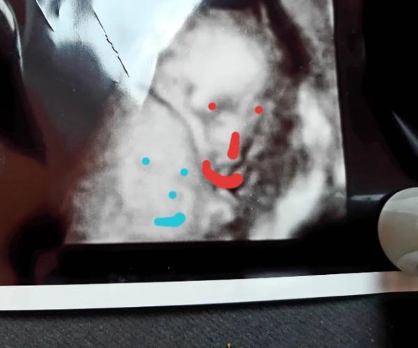 Bild zu 2 Baby ? - Mehrlinge - für Eltern mit Zwillingen, Drillingen und mehr