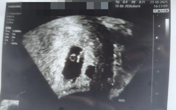 Bild zu Könnten das Zwillinge sein? - Mehrlinge - für Eltern mit Zwillingen, Drillingen und mehr