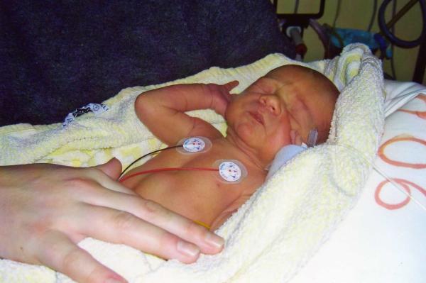 Bild zu Wollte uns mal vorstellen! - Frühchen - für Eltern mit frühgeborenen Babys
