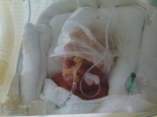 Bild zu Mein ganzer Stolz!!! - Frühchen - für Eltern mit frühgeborenen Babys
