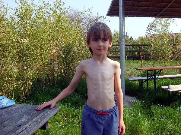 Bild zu