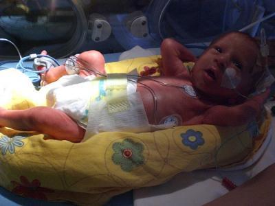 Bild zu 4 Monate zwischen diesen Bildern - Frühchen - für Eltern mit frühgeborenen Babys