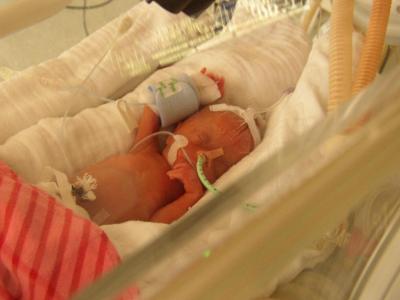 Bild zu Geschafft - Frühchen - für Eltern mit frühgeborenen Babys