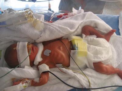 Bild zu Unser ganz persönlicher Jahresrückblick - Frühchen - für Eltern mit frühgeborenen Babys