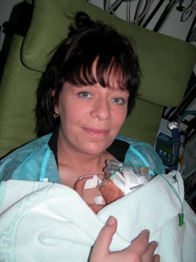 Bild zu Halloo - Frühchen - für Eltern mit frühgeborenen Babys