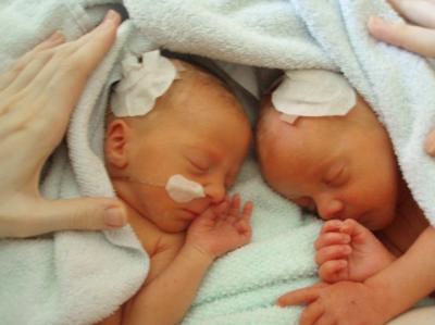 Bild zu Damals... - Frühchen - für Eltern mit frühgeborenen Babys