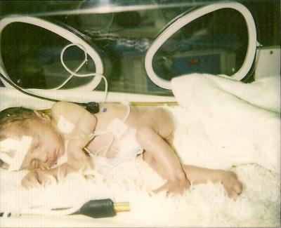 Bild zu Heute vor 18 Jahren - Frühchen - für Eltern mit frühgeborenen Babys