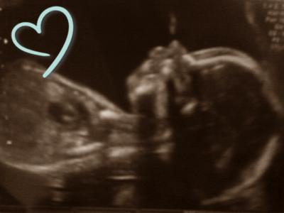 Bild zu Frühchen - Frühchen - für Eltern mit frühgeborenen Babys