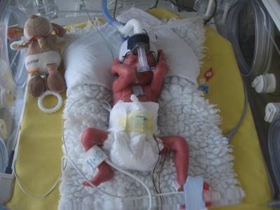 Bild zu Frühchentag....Wir sagen DANKE - Frühchen - für Eltern mit frühgeborenen Babys