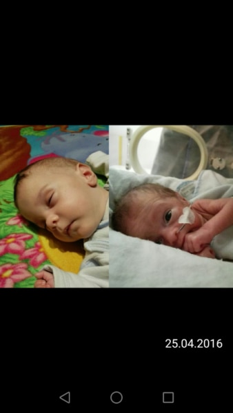 Bild zu Ein kleiner Vergleich der bei vielen Evtl untergeht - Frühchen - für Eltern mit frühgeborenen Babys