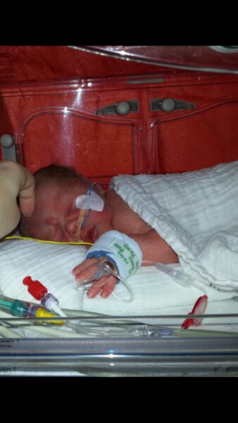 Bild zu Unser Lennart ist da bei 34+2 - Frühchen - für Eltern mit frühgeborenen Babys