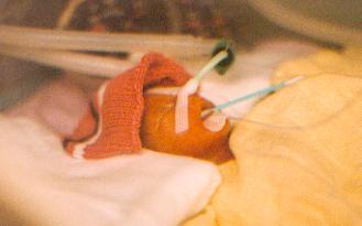 Bild zu Jetzt wird der Kerl bald 20 - Frühchen - für Eltern mit frühgeborenen Babys