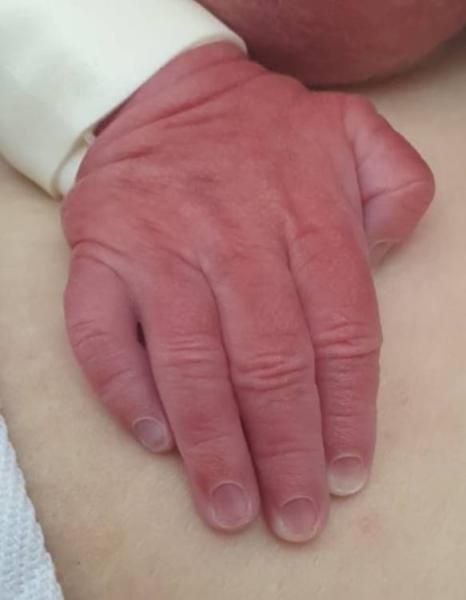 Bild zu Ausgekugelt 31+3 ehemaliger Juli Bus - Frühchen - für Eltern mit frühgeborenen Babys