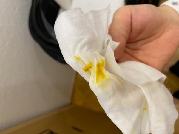 Bild zu Rote Fäden im Stuhl nach Banane - Der erste Brei - die Beikost