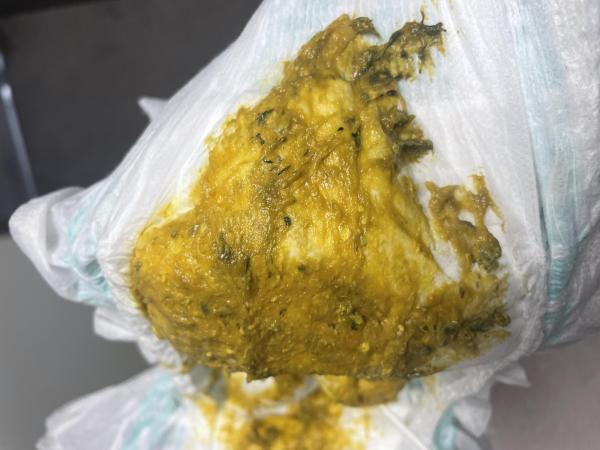 Bild zu Normaler Stuhlgang bei meinem 6 Monate altem Baby?? Achtung Bild! - Der erste Brei - die Beikost