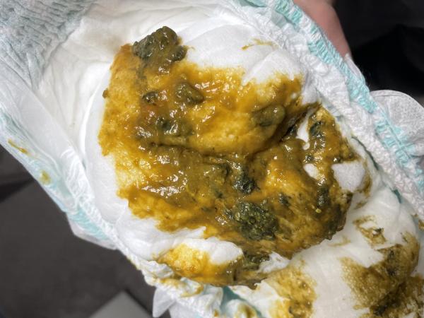 Bild zu Normaler Stuhlgang bei meinem 6 Monate altem Baby?? Achtung Bild! - Der erste Brei - die Beikost