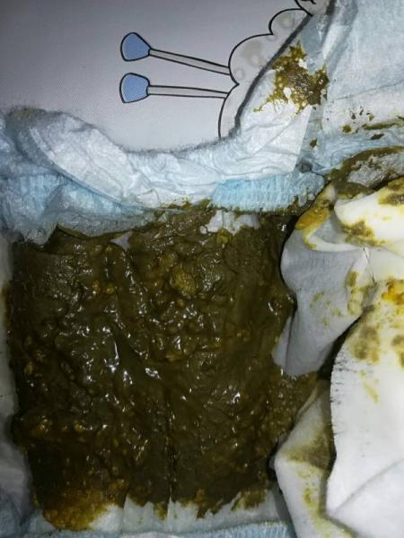 Bild zu Baby Nahrung - Fläschchennahrung - Milch aus dem Fläschchen fürs Baby