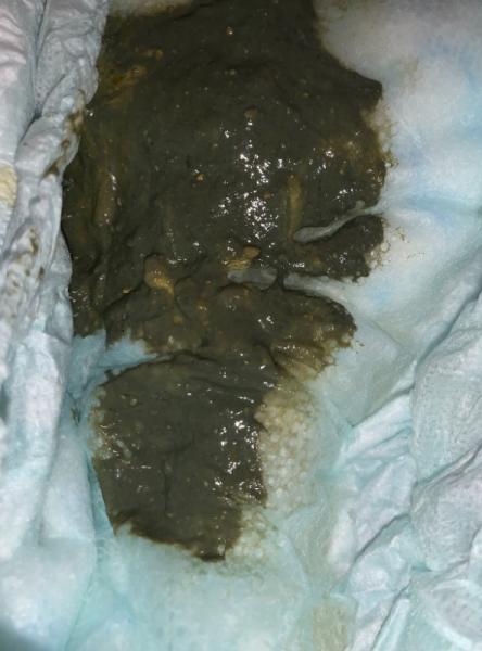 Bild zu Baby kacka sieht ganz komisch aus - Fläschchennahrung - Milch aus dem Fläschchen fürs Baby
