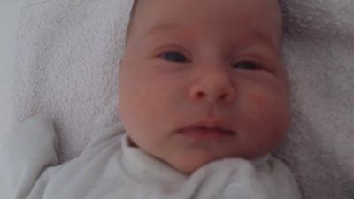 Bild zu Pickelchen vom Spucken?! - Babys 1. Lebensjahr