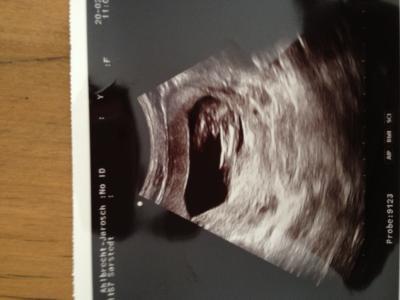 Bild zu Ist es ein Junge oder ein Mädchen? - Babys 1. Lebensjahr