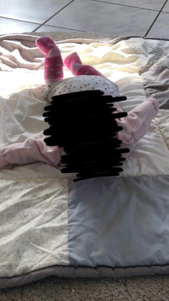 Bild zu Fehlender Unterarm-Stütz - Babys 1. Lebensjahr