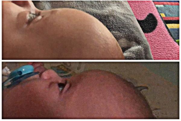 Bild zu KU-Frühchen - Babys 1. Lebensjahr