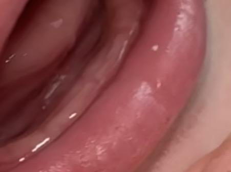 Bild zu Zahnen? - Babys 1. Lebensjahr