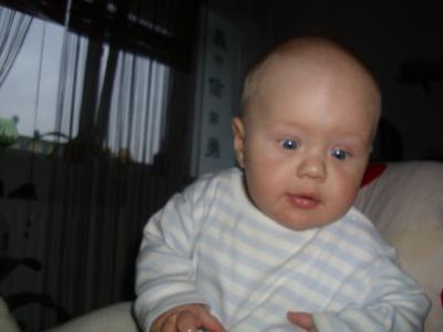 Bild zu Unser Sohn bekommt Zähne bitte um ratschläge!!! - Babypflege - so pflegen Sie Ihr Baby richtig